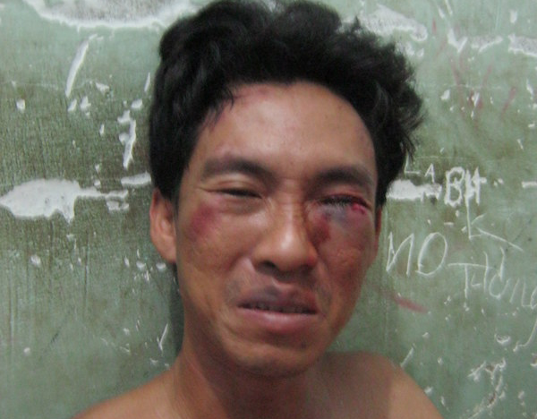 Khong che be gai 8 tuoi vi bi phat hien khi trom xe hinh anh