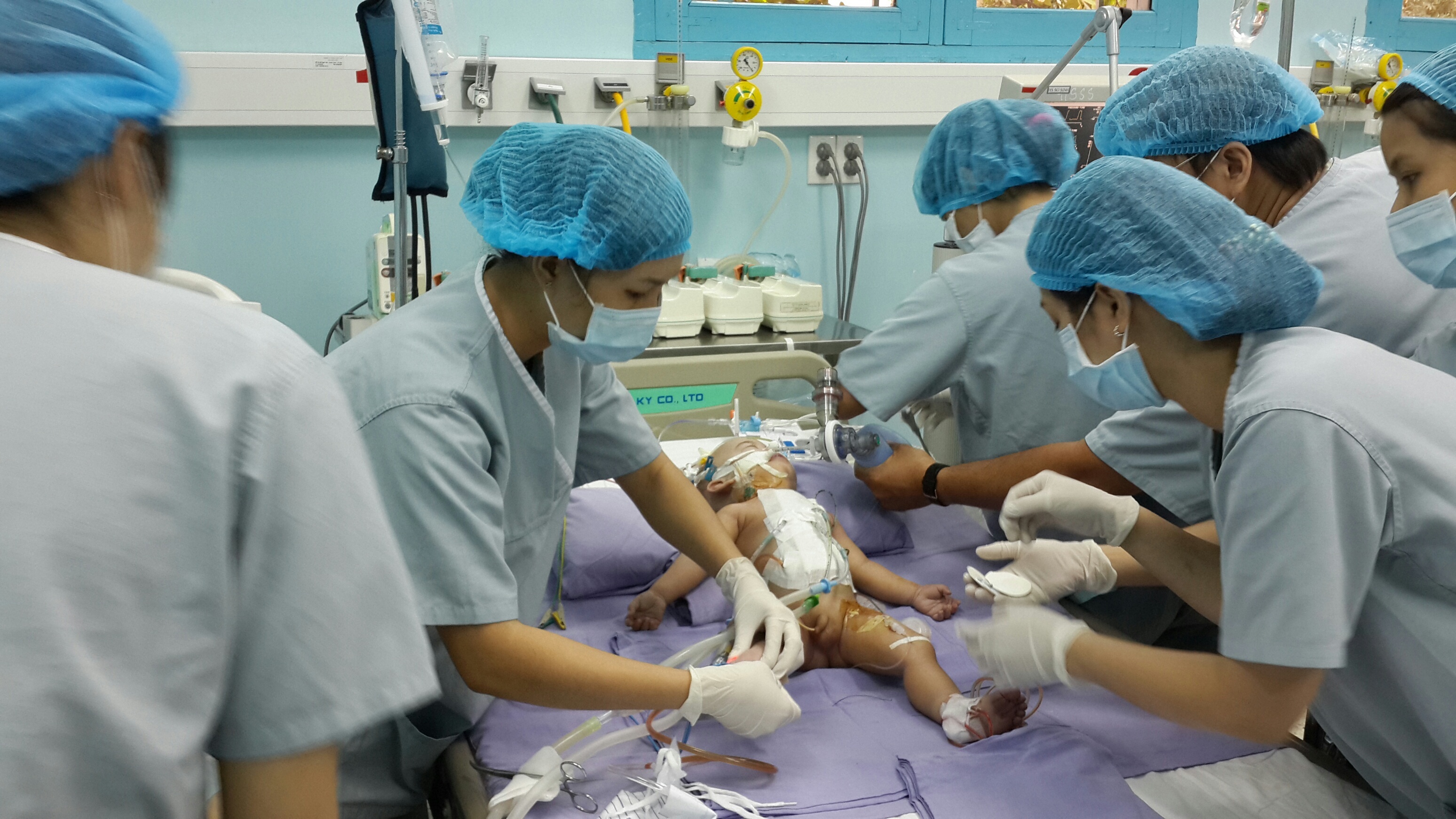 Nhung dieu chua biet trong ca mo tach 2 be dinh lien hinh anh