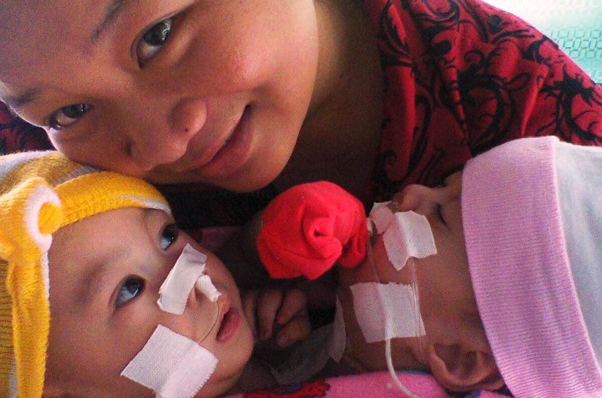 2 be so sinh dinh tim: Sinh con 11 thang, be con duoc 1 gio hinh anh