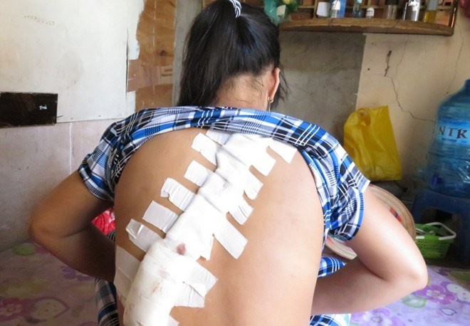 Mot thieu nu bi giang ho Sai Gon chem rach lung hinh anh