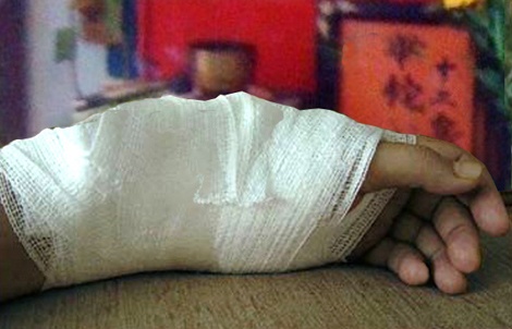 Gia nat ga con dang song de... chua gay xuong o Long An hinh anh