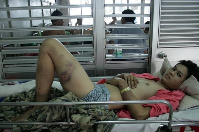 Ke danh gay chan nguoi yeu con gai bi de nghi truy to hinh anh