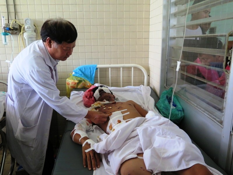 No min danh ca, 2 anh em bi cut tay, mu mat hinh anh