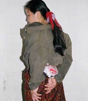 Ma tuý được cất giấu trong cơ thể.