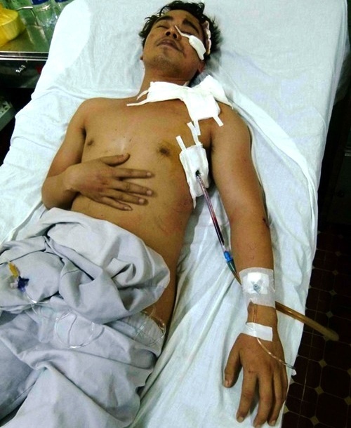 MC Phạm Tân bị cướp đâm thủng phổi đang điều trị tại bệnh viện 175.