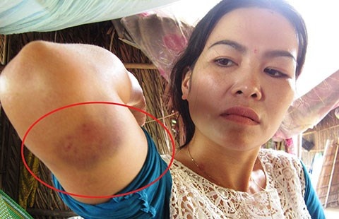 Hai co gai to bi... 'tha de' hinh anh