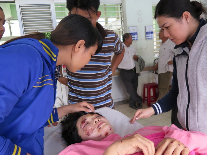 Giay phut bi gach ngoi, kinh vo bay cua vao mat hinh anh