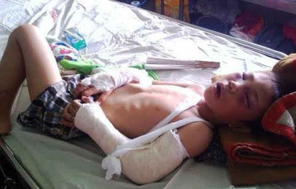 Be 6 tuoi bi nguoi tinh cua me danh ca ngay, nut so nao hinh anh