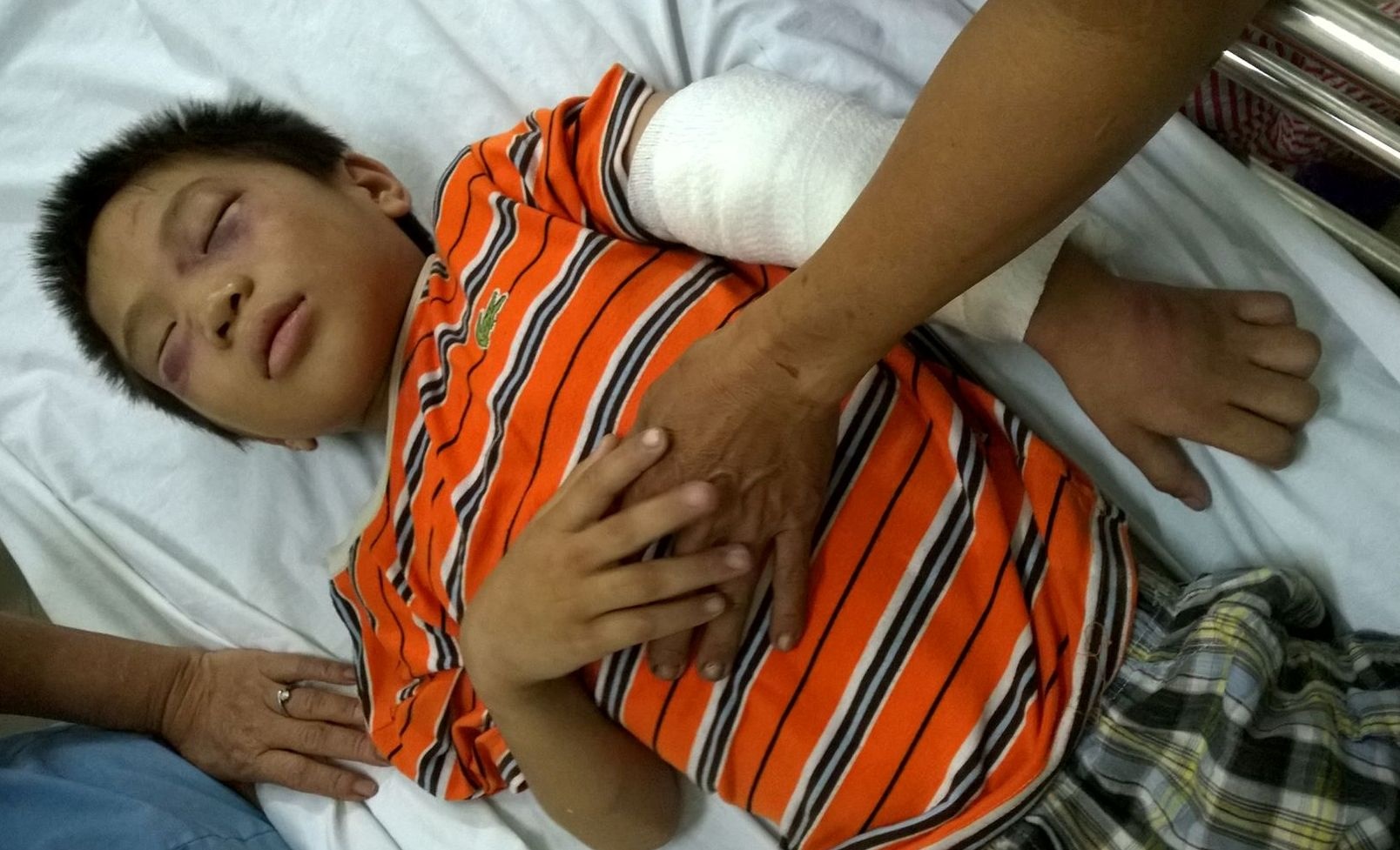 Be trai bi nguoi tinh cua me danh gay tay chan hinh anh