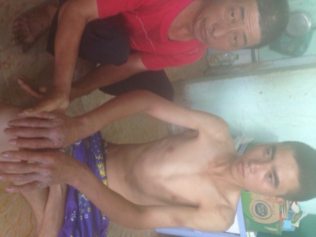 Theo Trần Văn Tuân, những vết sẹo trên thân thể là do người quản lý cây xăng đánh đập trong nhiều năm.