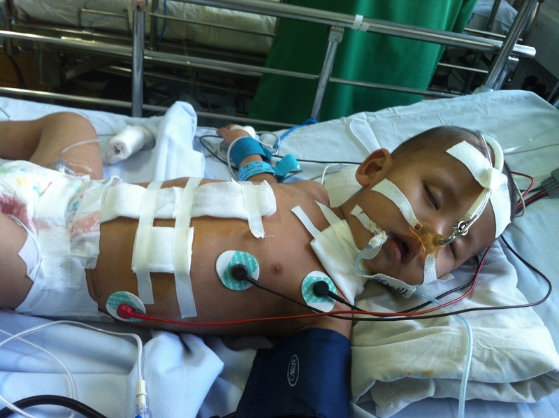 Be trai 2 tuoi nam vien 1 nam do uong axit hinh anh