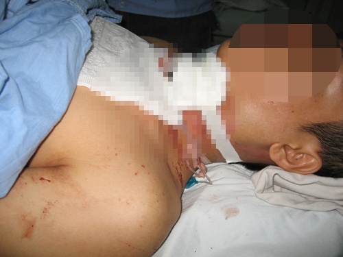 Day phoi cua dut co hong nguoi di duong hinh anh