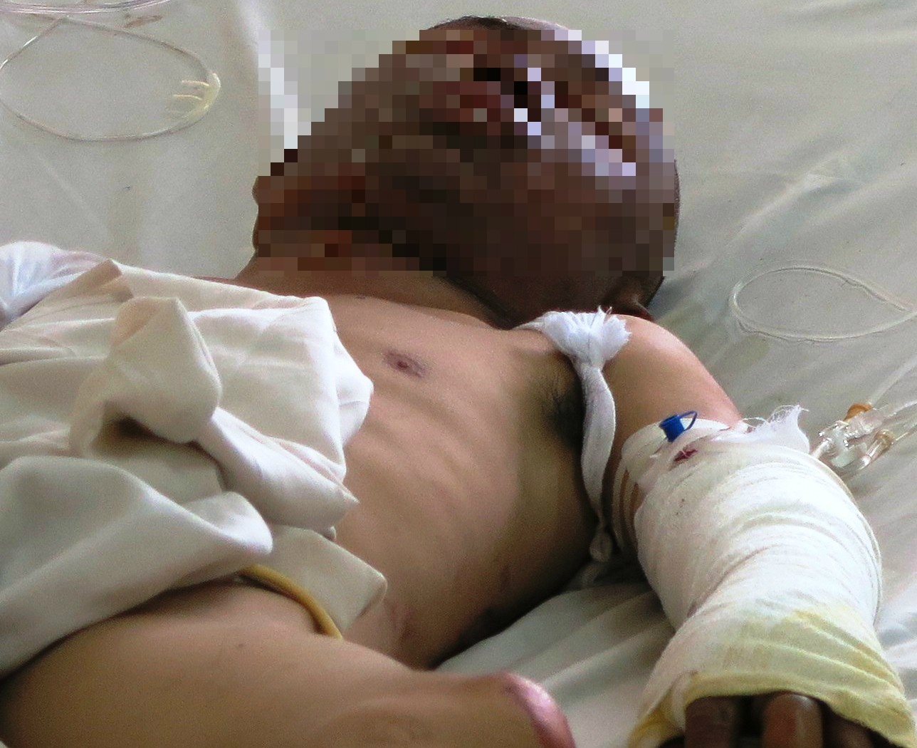 Xong vao ngoi nha chay cuu con gai, cha bi bong nang hinh anh