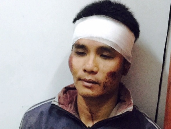 Loi khai ke cam sung cuop tiem vang o Sai Gon hinh anh