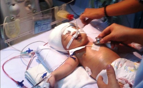 Be so sinh bi dam xuyen so phai dieu tri 3 loai khang sinh hinh anh