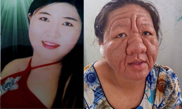 Co gai 20 tuoi thanh ba lao 70 vi tac dung phu cua thuoc hinh anh