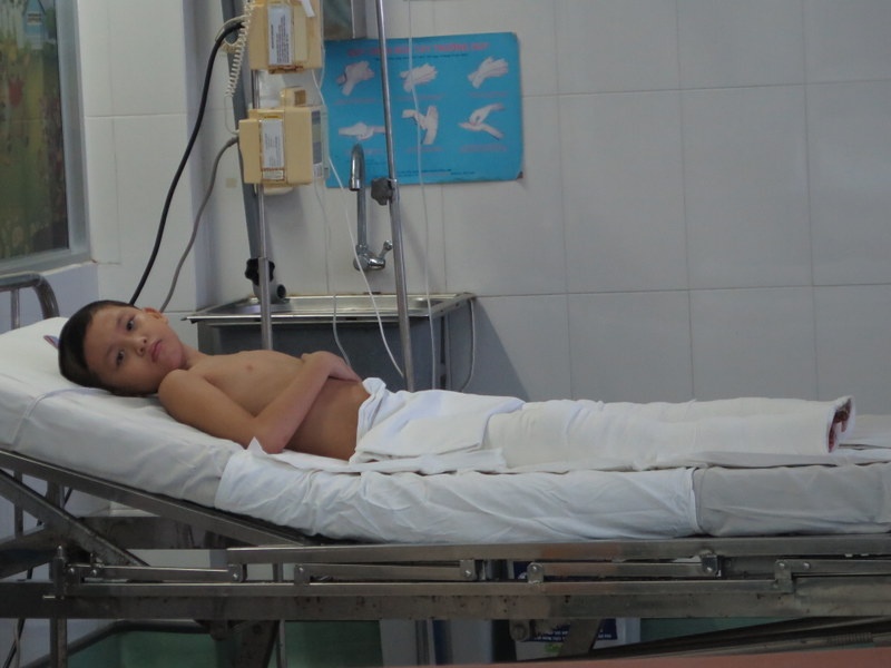 Nga vao ho tro nong, be trai bi bong nang 2 chan hinh anh