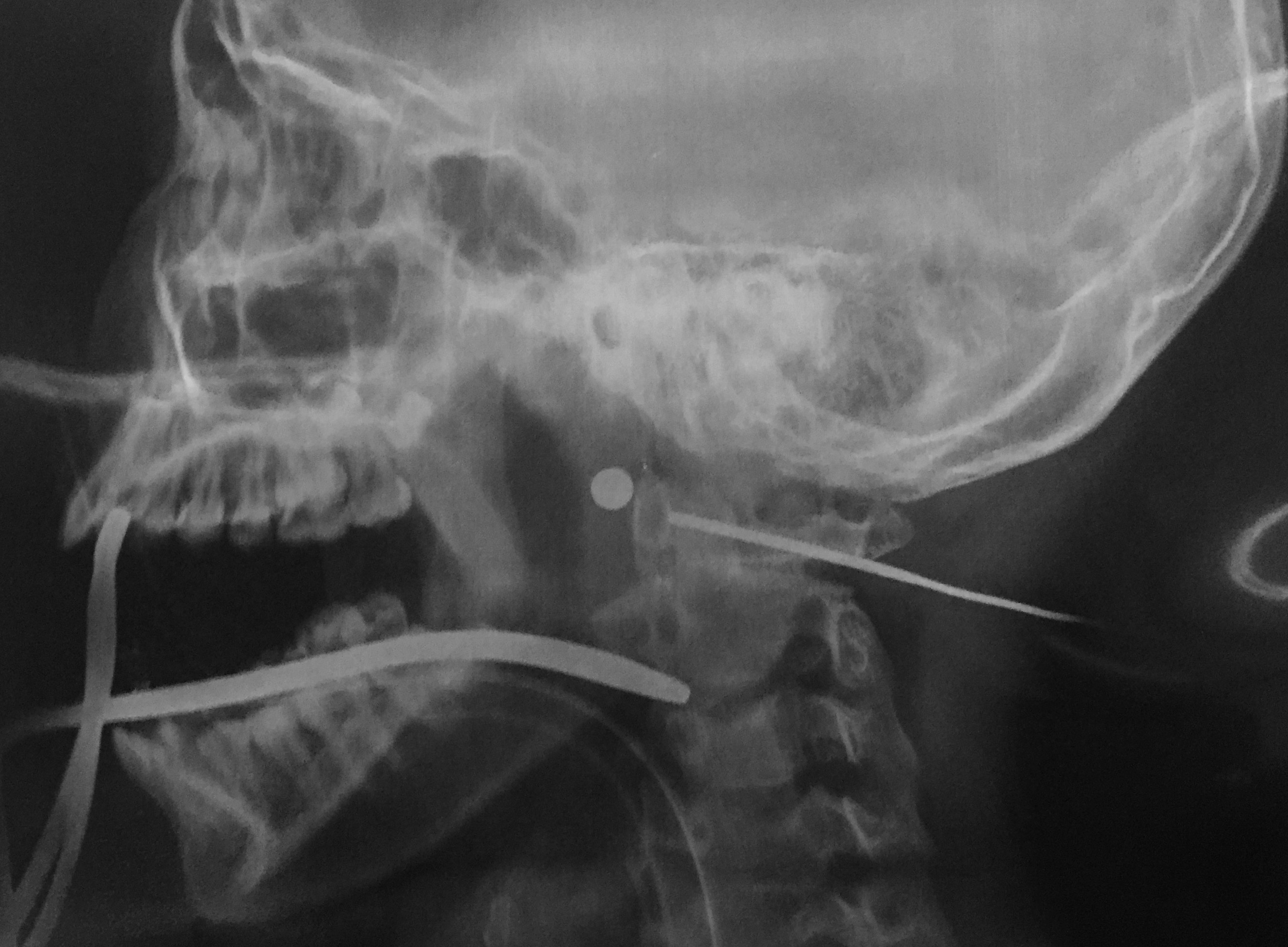 Nu sinh 13 tuoi bi dan bi ban xuyen co hinh anh