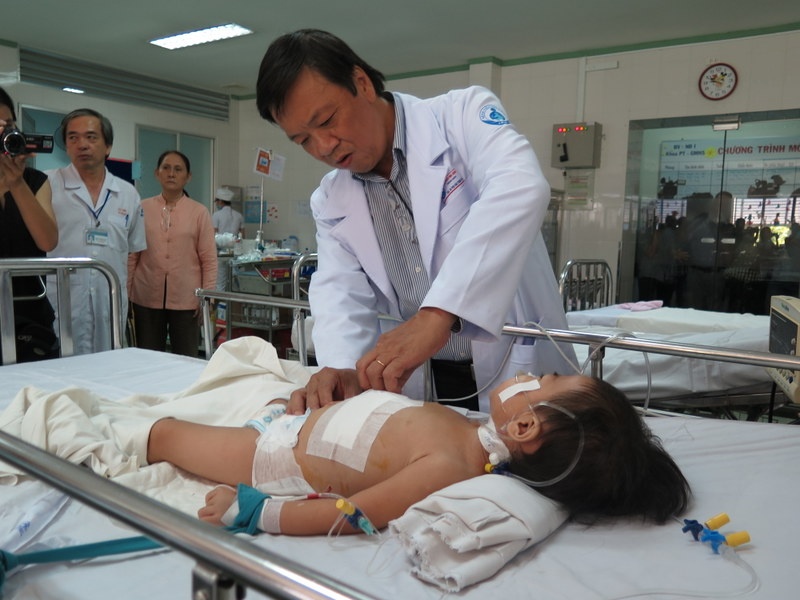 Cat khoi buou nang 1,3 kg trong gan be gai 2 tuoi hinh anh