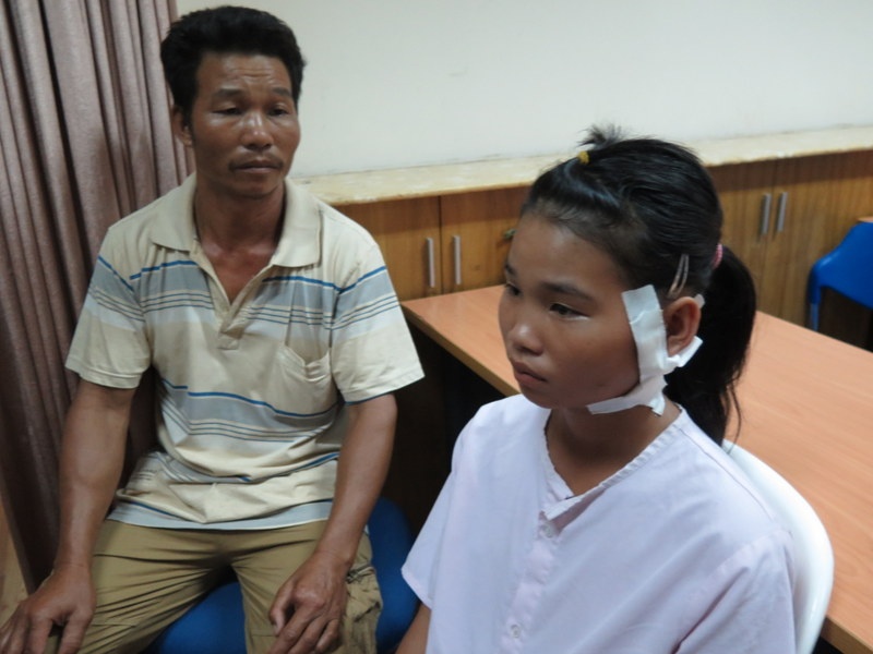 Bệnh nhi bị đạn lạc trong tai đã được hồi phục. Ảnh: Khánh Trung.