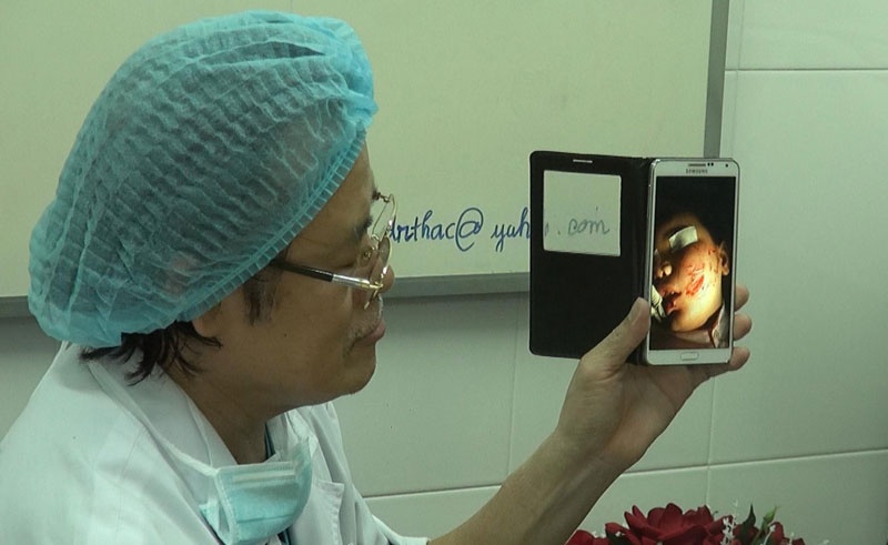 Em be 3 tuoi bi cho can nat mat phai khau 200 mui hinh anh