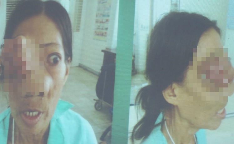 Cuu song nguoi phu nu ban ve so bi u xam lan nao hinh anh