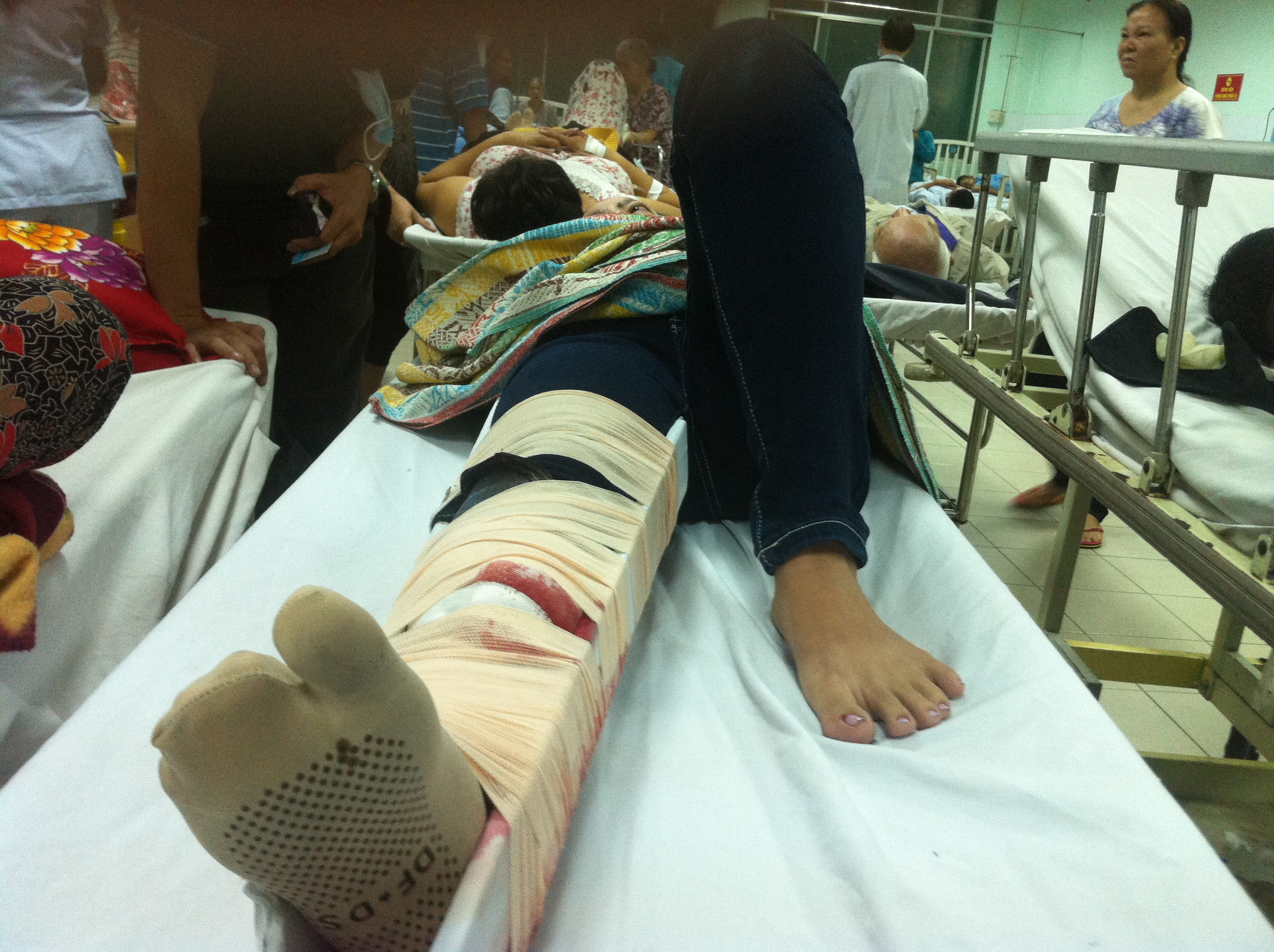 Xe 'dien' tong nan nhan lan nhieu vong hinh anh