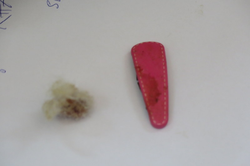 Cap cuu 2 be gai nhet do choi vao vung kin hinh anh