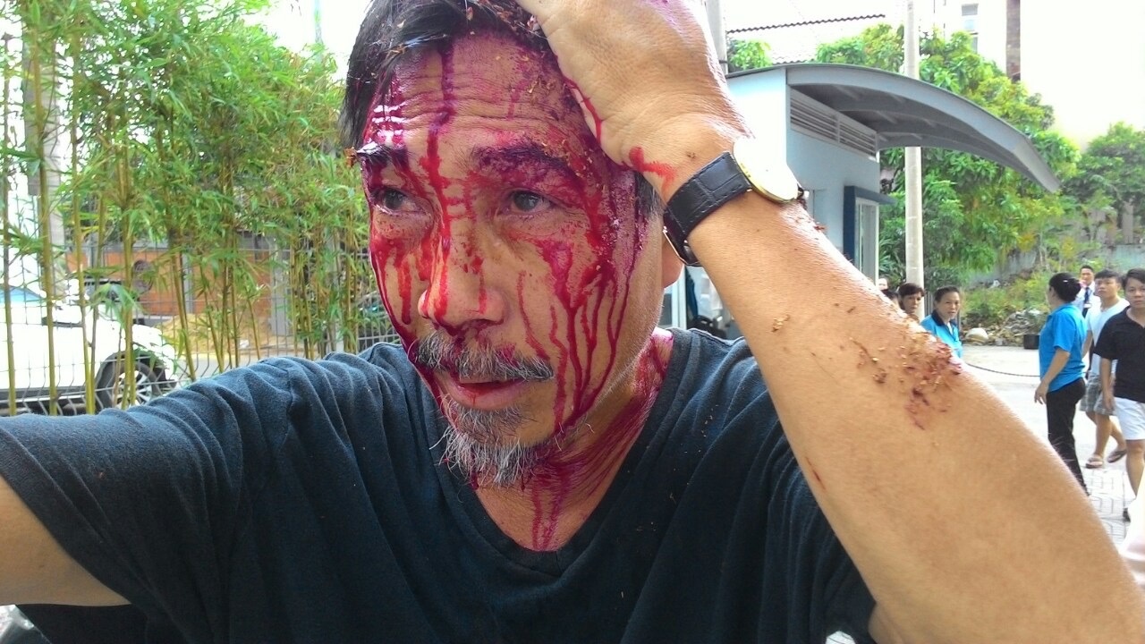 Con do pha cong chung cu, danh dan chay mau dau hinh anh