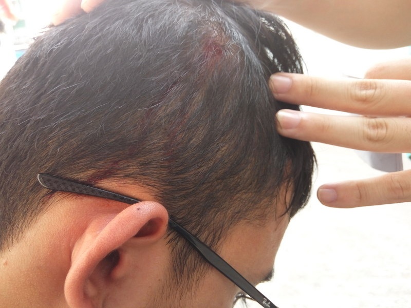 Dieu tra vu sinh vien di xin viec bi danh vo dau hinh anh