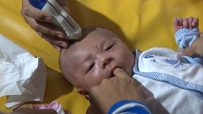 Nao be trai o mien Tay bi dao dam xuyen so phinh to hinh anh