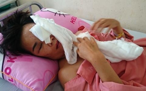 Noi lai tinh cam khong thanh, thue nguoi tat axit vo cu hinh anh