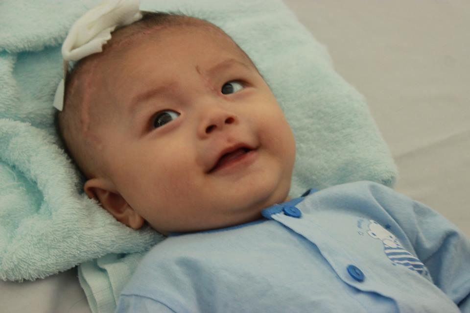 Be bi dao dam xuyen so o mien Tay xuat vien lan 3 hinh anh