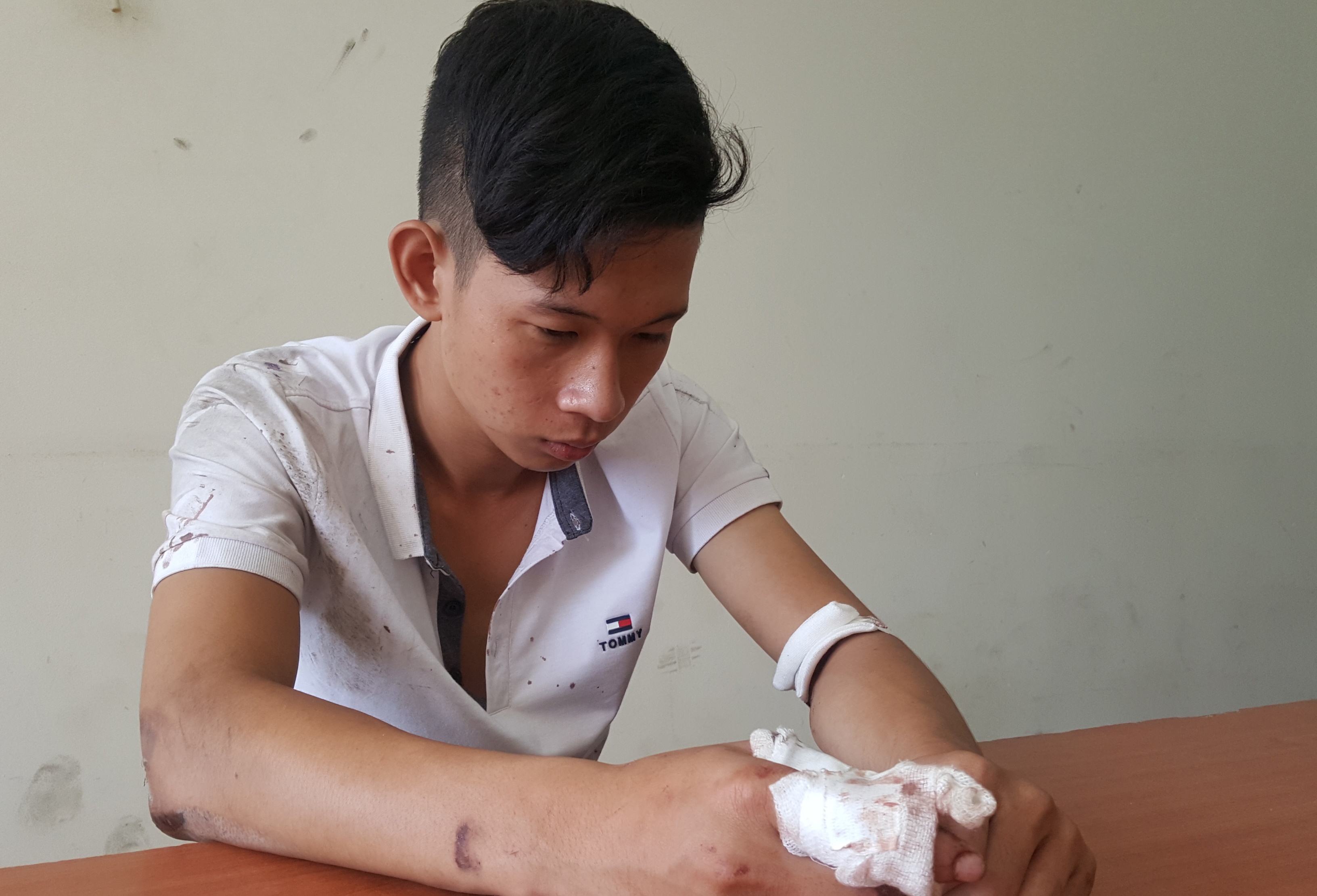 Hon chien sau va quet xe, mot nguoi bi dam chet hinh anh
