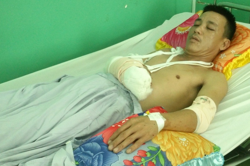 con do chem nguoi o sai gon anh 1