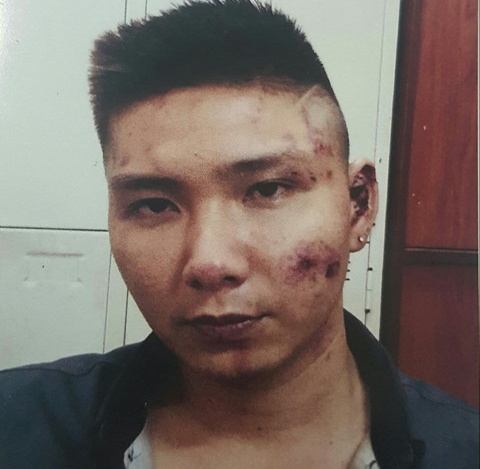 dân chơi hỗn chiến trong quán bar ảnh 1 dan choi hon chien trong quan bar anh 1