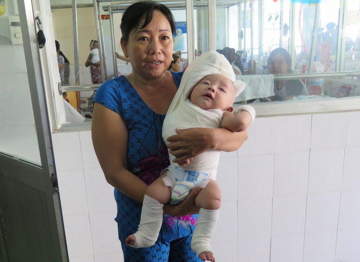 mổ liệt thần kinh cánh tay miễn phí ảnh 1 mo liet than kinh canh tay mien phi anh 1