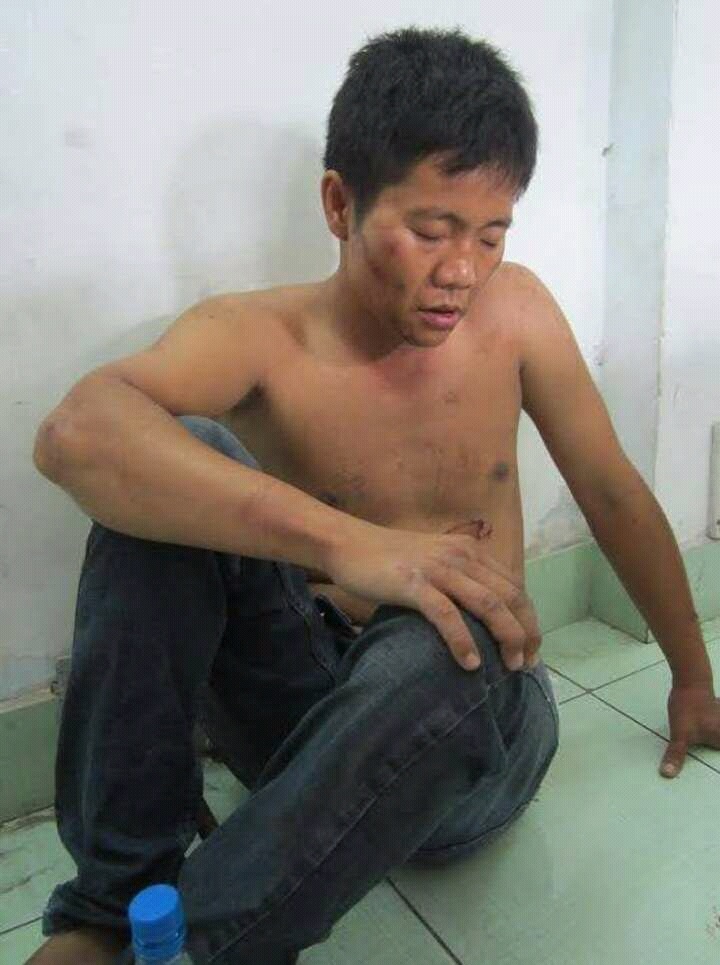 cảnh sát nổ súng bắt cướp ở sài gòn ảnh 1 canh sat no sung bat cuop o sai gon anh 1