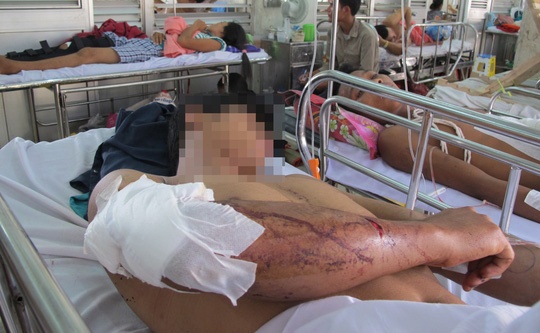 20 giang ho Sai Gon chem nguoi do mau thuan trong ho boi hinh anh