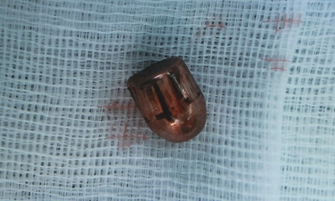 trung ta campuchia ban nguoi anh 2