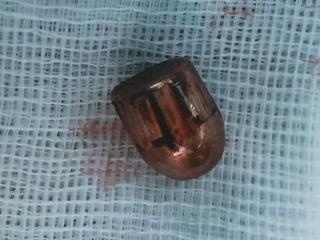 Gap dau dan ra khoi co nan nhan bi trung ta Campuchia ban hinh anh