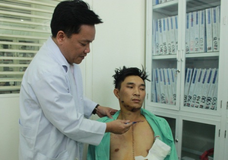 Bi ban 3 phat sung vi can con do danh anh trai hinh anh