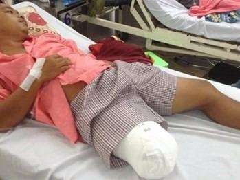 Benh vien nhan sai sot vu cua chan, hua se co trach nhiem hinh anh