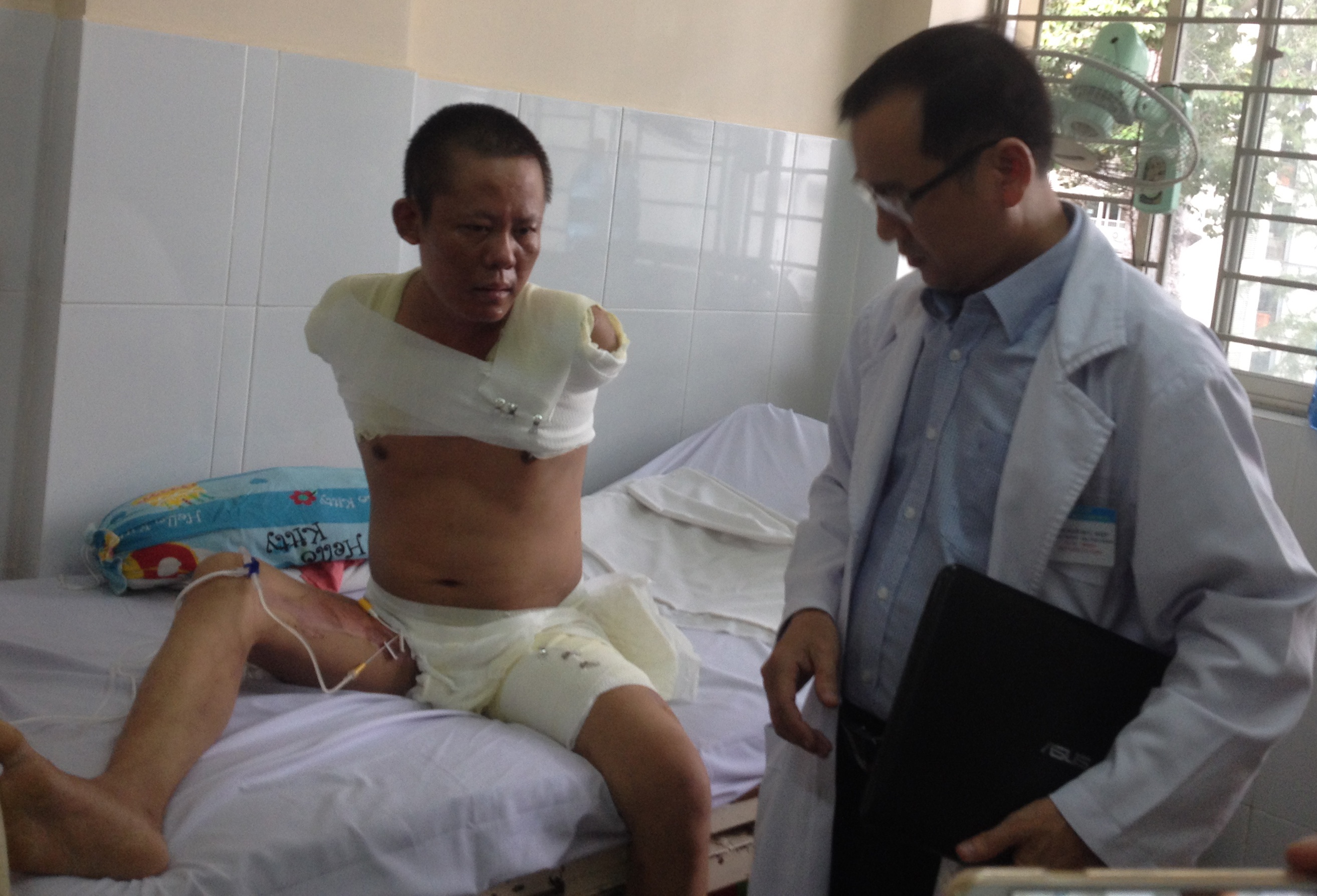 Canh bao cua cut tay chan vi dien giat hinh anh