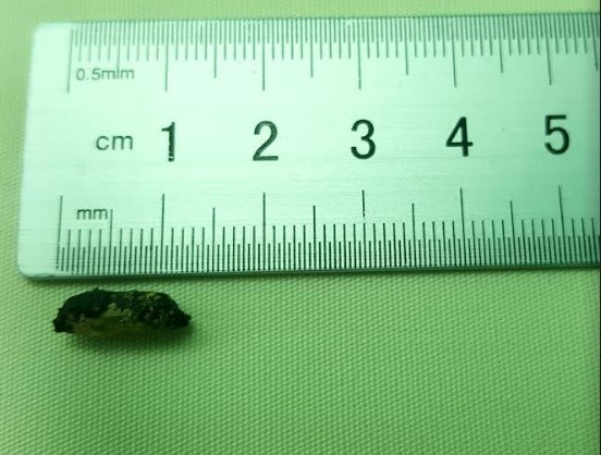 đạn găm vào tim ảnh 1 dan gam vao tim anh 1