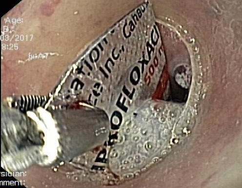 Suyt thung thuc quan vi nuot vo thuoc hinh anh