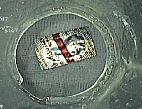 Nuốt vỏ viên thuốc ảnh 2 Nuot vo vien thuoc anh 2