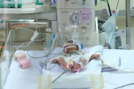 20 ngay can nao truoc ca mo tim cuu be gai sinh non nang 900 gr hinh anh