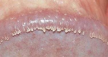 Bác sĩ Trung Quốc lừa bệnh nhân ảnh 1 Bac si Trung Quoc lua benh nhan anh 1