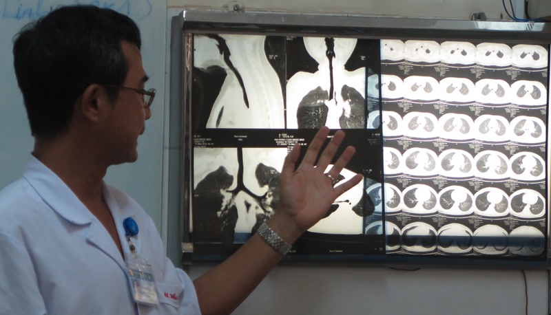 Ken chui vao phoi anh 1